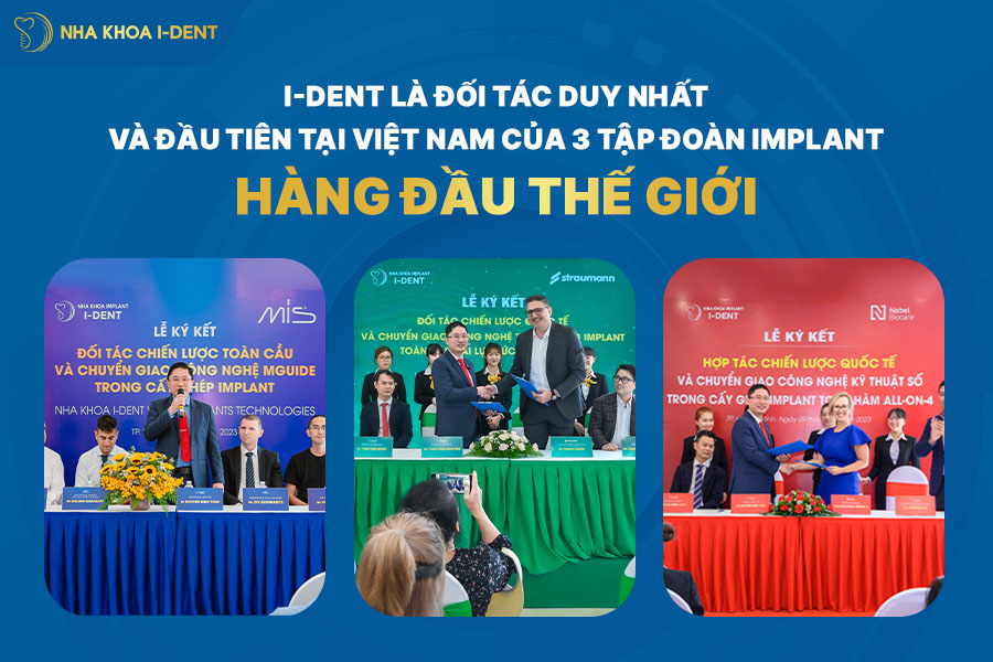 bảng giá trồng răng
