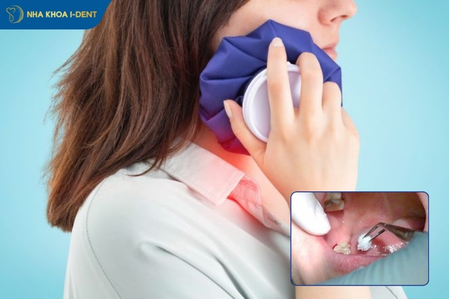 nhổ răng khôn đau mấy ngày