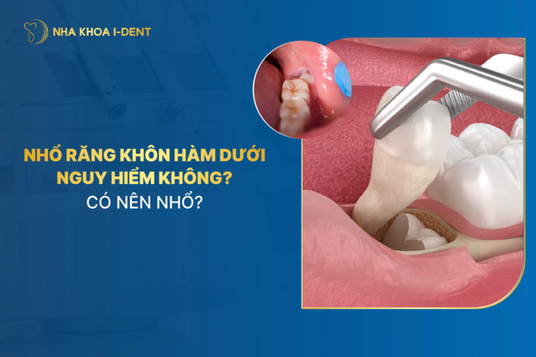 nhổ răng khôn hàm dưới có nguy hiểm không