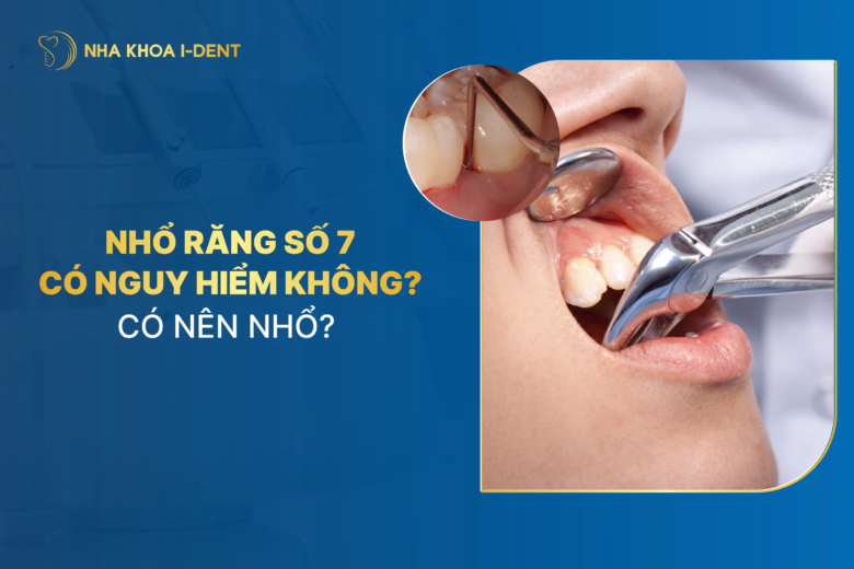 nhổ răng số 7