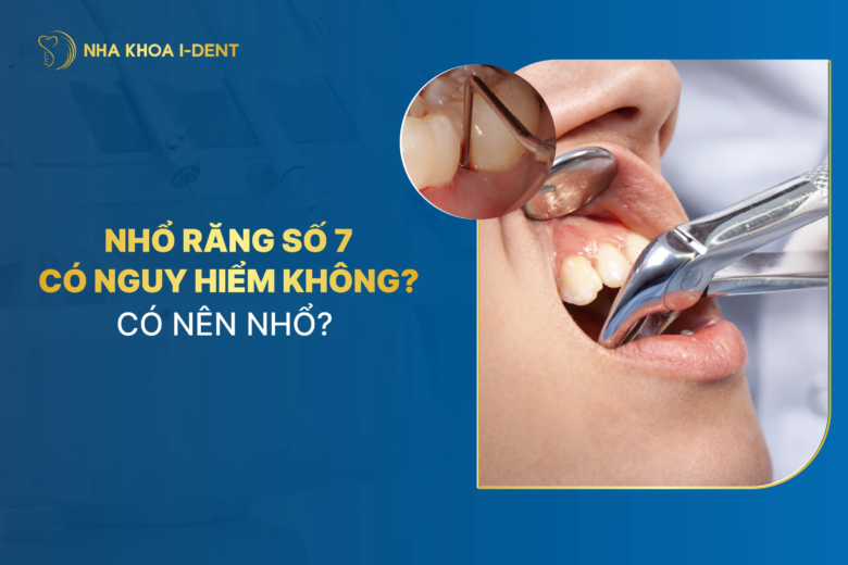 Nhổ răng số 7: Ảnh hưởng gì? Có nên trồng lại? Có nên nhổ?