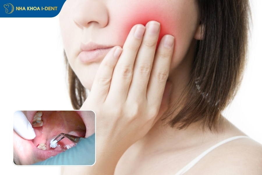 nhổ răng số 8 có ảnh hưởng gì không