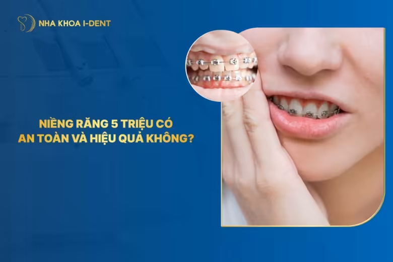 Niềng răng 5 triệu có an toàn và hiệu quả? | Nha khoa I-Dent