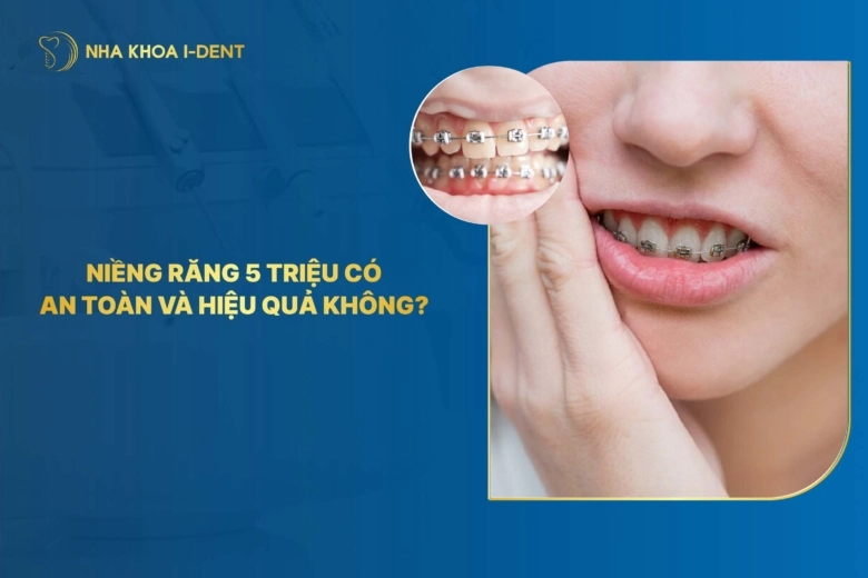 Niềng răng 5 triệu có an toàn và hiệu quả? | Nha khoa I-Dent