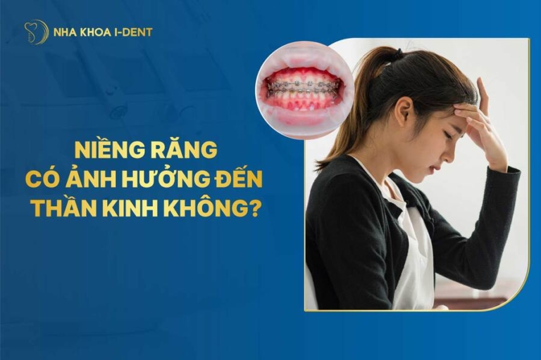 niềng răng có ảnh hưởng đến thần kinh không