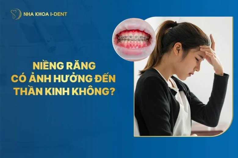 niềng răng có ảnh hưởng đến thần kinh không