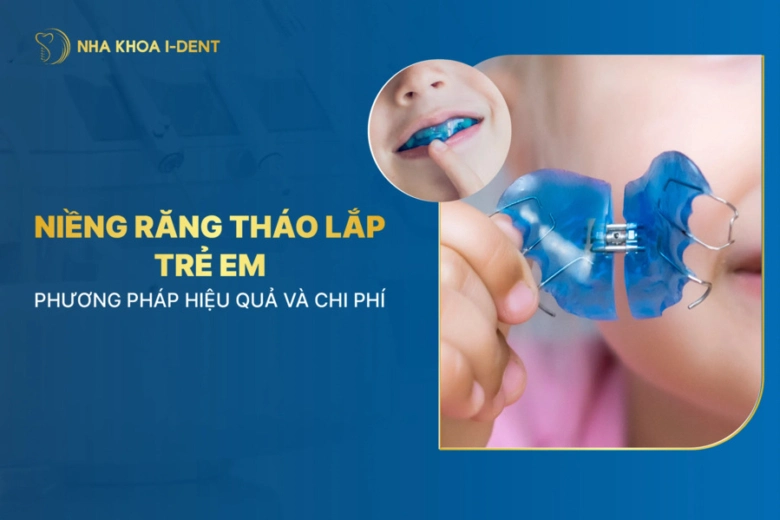 niềng răng tháo lắp trẻ em