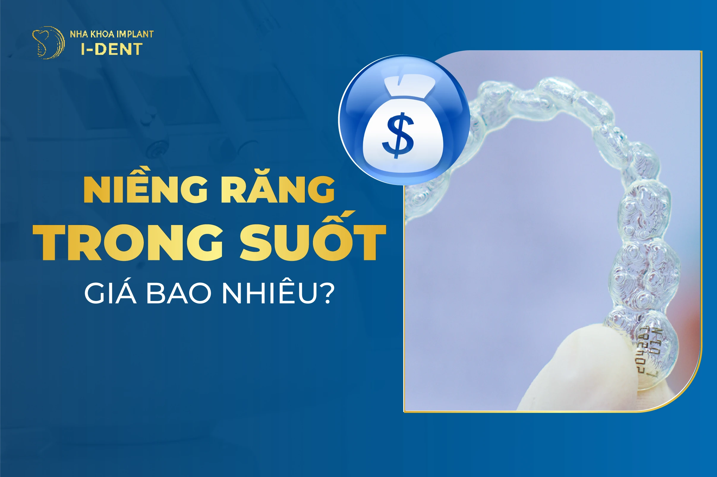 [T3/2026] Niềng răng trong suốt giá bao nhiêu? Giá niềng chi tiết
