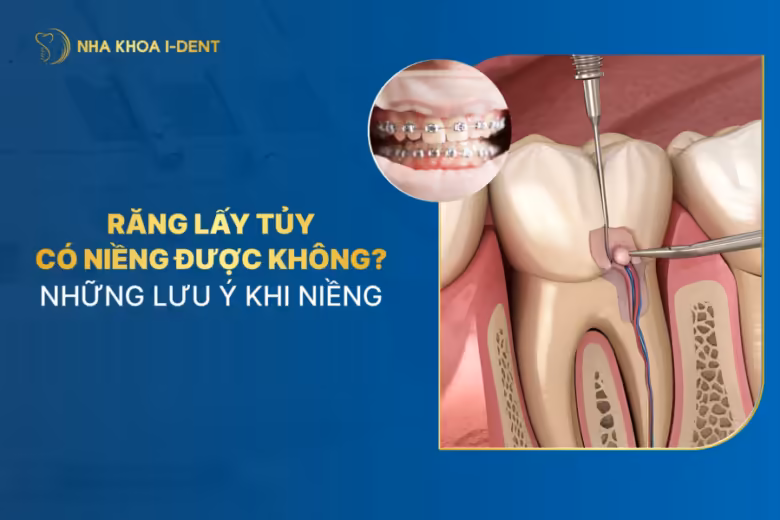 răng đã lấy tủy có niềng được không
