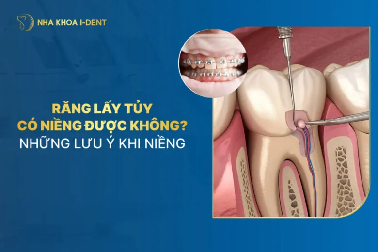 răng đã lấy tủy có niềng được không