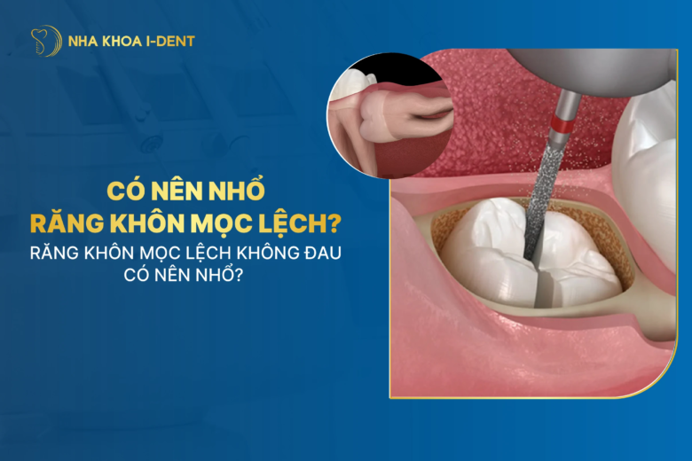 Răng khôn mọc lệch có nên nhổ không? Có sao không? 