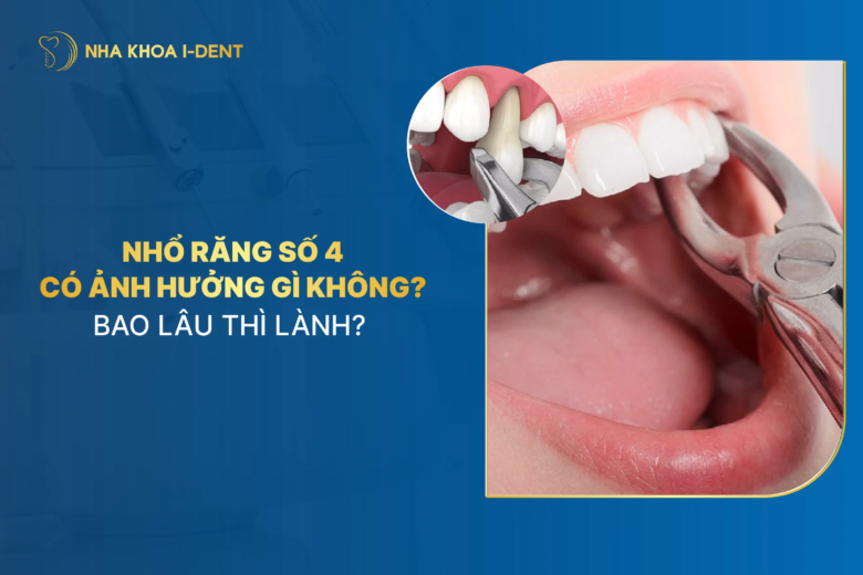 tác hại của việc nhổ răng số 4