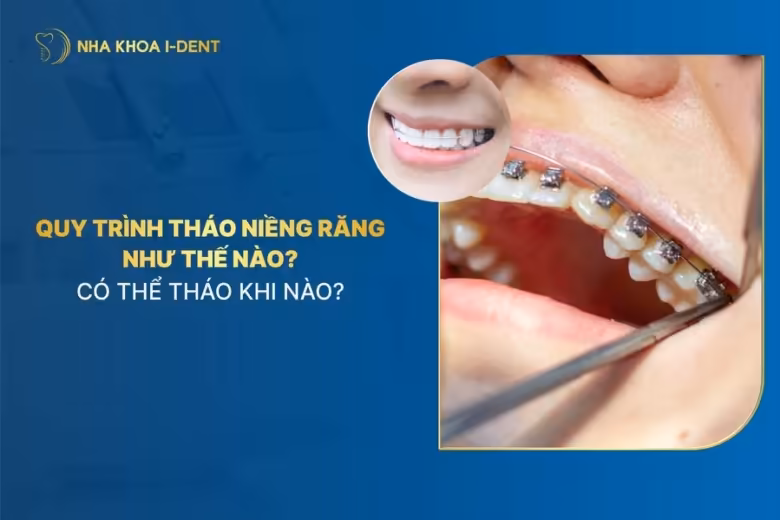 tháo niềng răng