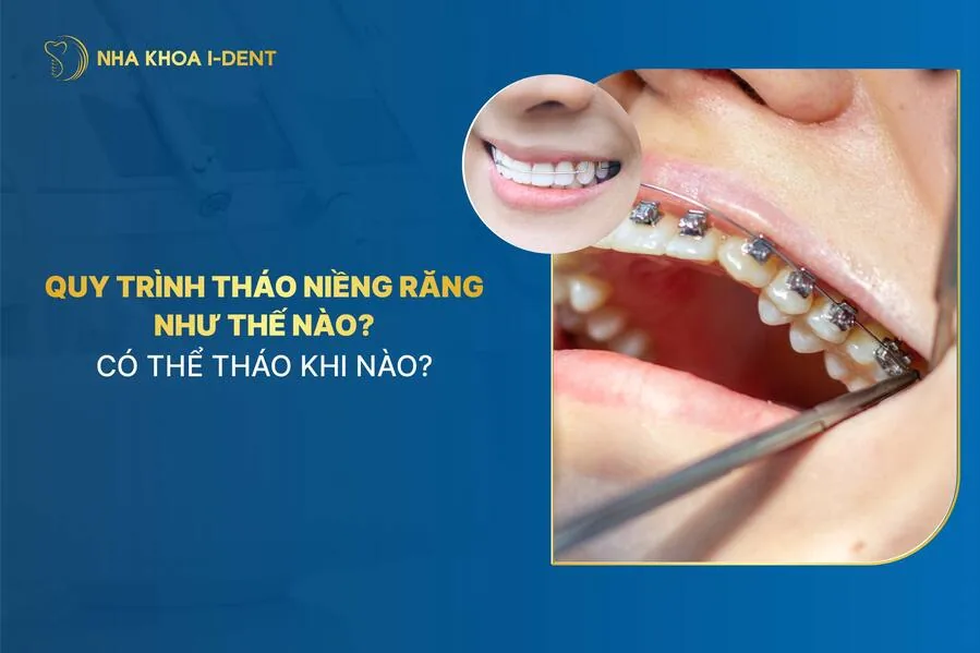 tháo niềng răng
