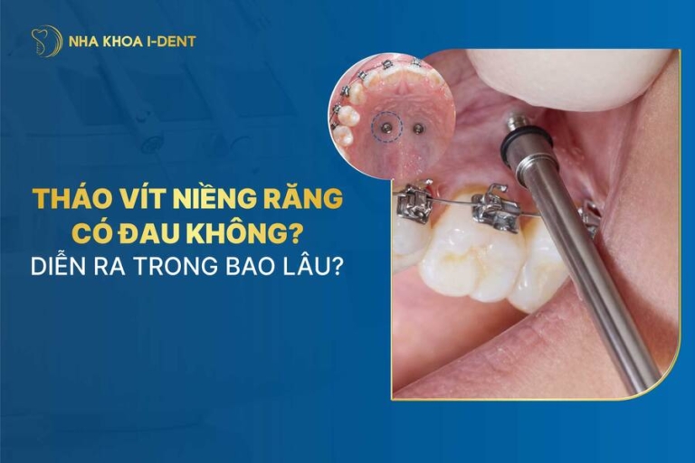tháo vít niềng răng có đau không