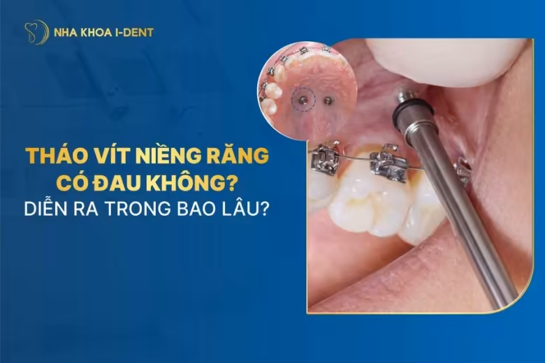 tháo vít niềng răng có đau không