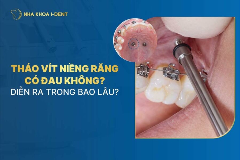 Tháo vít niềng răng có đau không? Mất bao lâu?