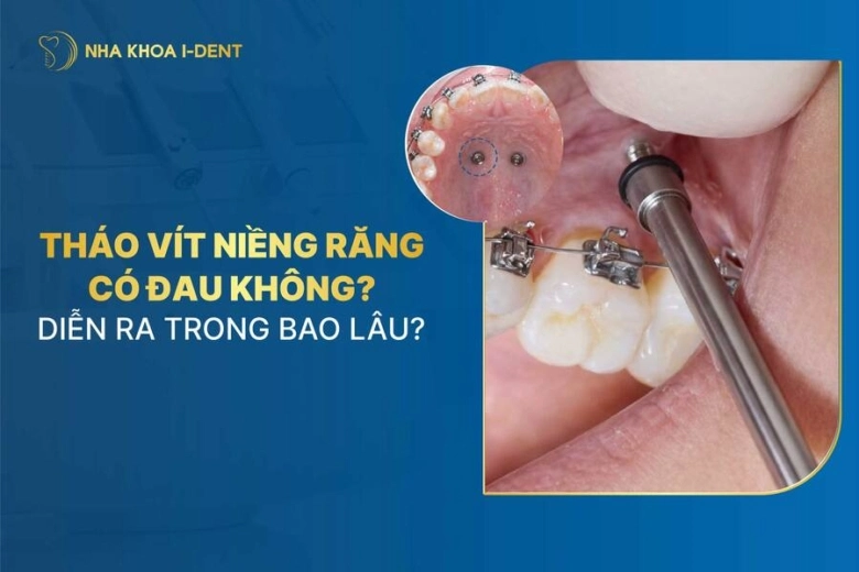 tháo vít niềng răng có đau không
