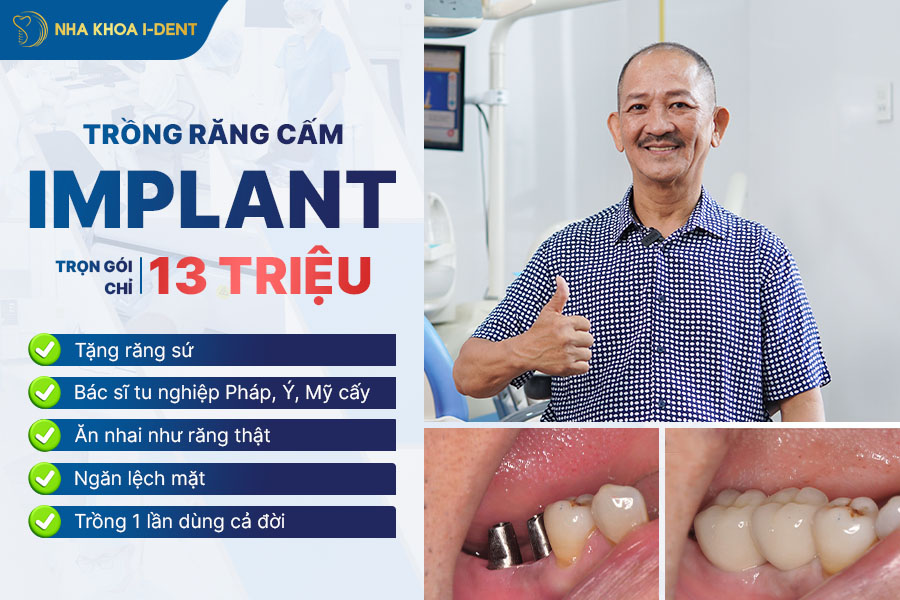 trồng răng cấm giá bao nhiêu triền