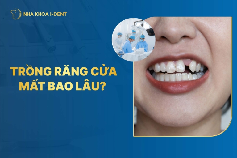 Trồng răng cửa mất bao lâu? Phương pháp nào?