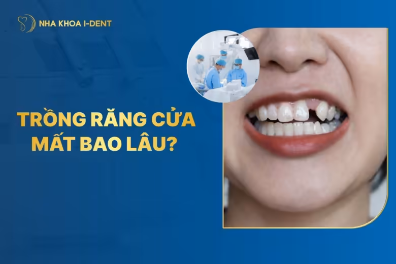 Trồng răng cửa mất bao lâu? Phương pháp nào?