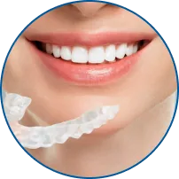 Invisalign Express