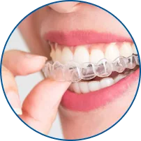 Invisalign Moderate