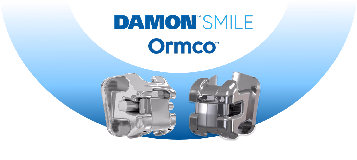 Hệ thống mắc cài Damon Ultima.