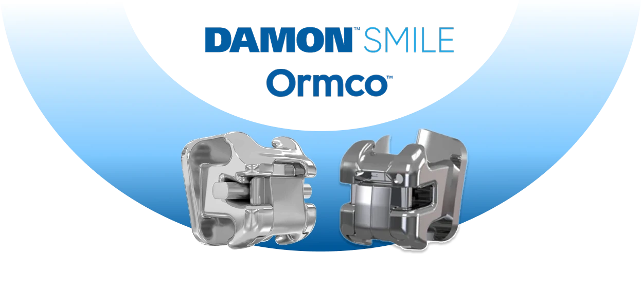 Hệ thống mắc cài Damon Ultima.