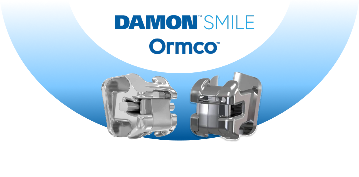 Hệ thống mắc cài Damon Ultima.