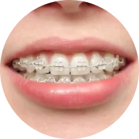 Sứ Tự Buộc