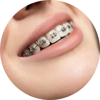 Kim Loại Tiêu Chuẩn