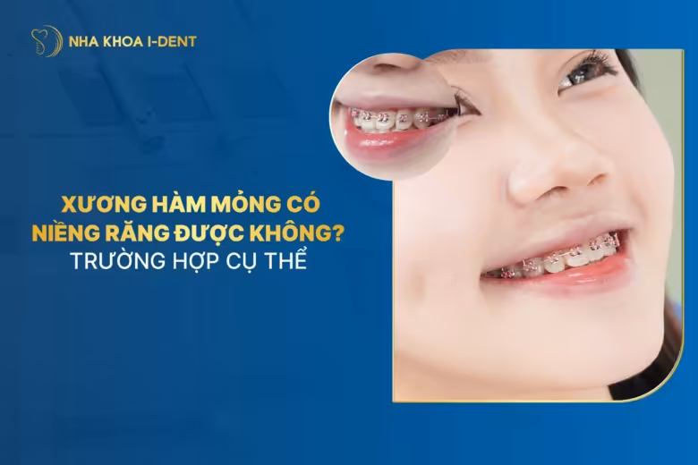 xương hàm mỏng có niềng răng được không
