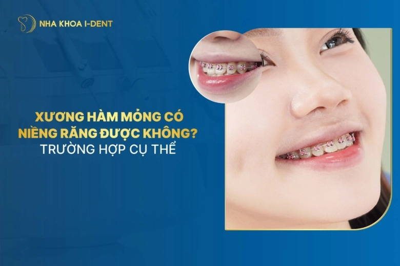 xương hàm mỏng có niềng răng được không