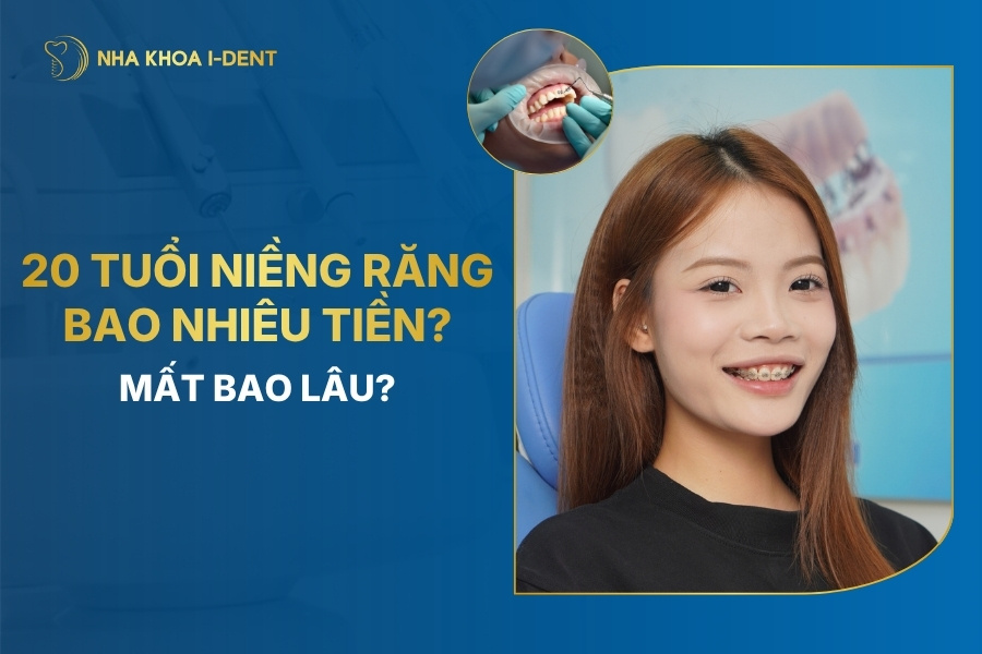 20 tuổi niềng răng bao nhiêu tiền