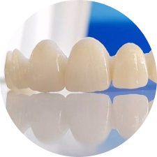 Răng sứ toàn sứ Multilayer DDBio