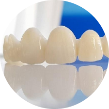 Răng sứ toàn sứ Multilayer DDBio