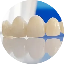 Răng sứ toàn sứ Multilayer DDBio