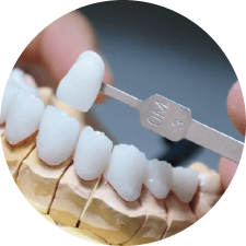 Răng sứ toàn sứ Lava Plus