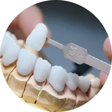 Răng sứ toàn sứ Lava Plus