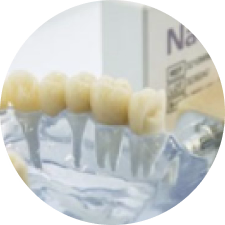 Răng sứ toàn sứ Nacera 9 Max