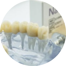 Răng sứ toàn sứ Nacera 9 Max