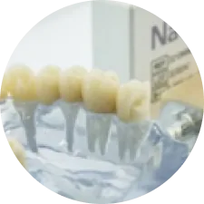 Răng sứ toàn sứ Nacera 9 Max