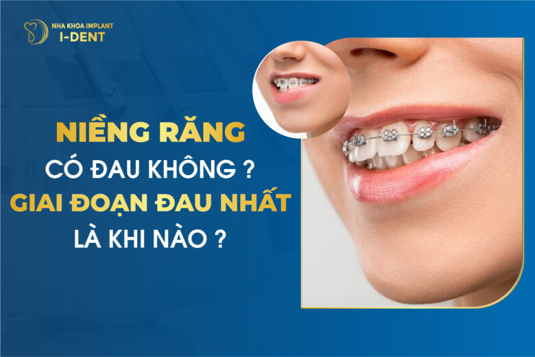 Niềng Răng Có Đau Không? Giai Đoạn Đau Nhất Là Khi Nào?