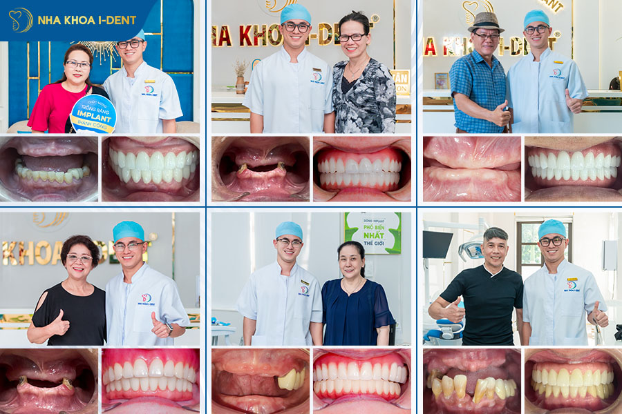 bác sĩ cấy ghép implant giỏi tphcm