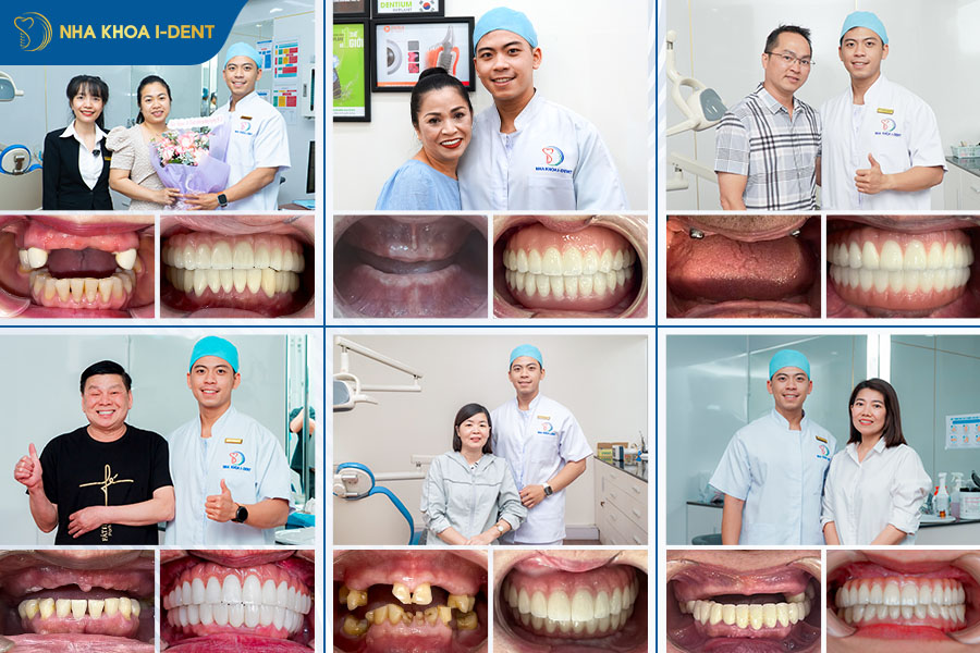 bác sĩ cấy ghép răng implant