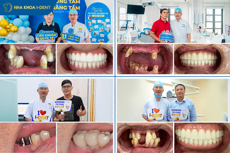 bác sĩ trồng implant giỏi