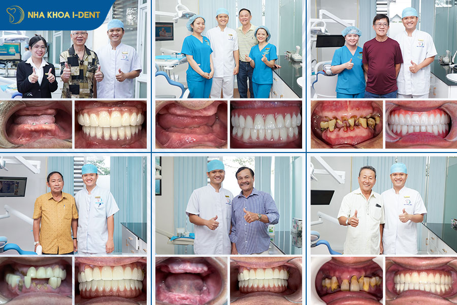 bác sĩ trồng implant tphcm