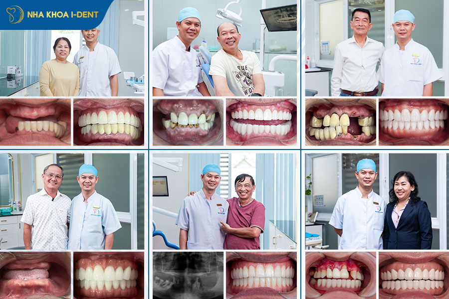 bác sĩ trồng răng implant giỏi