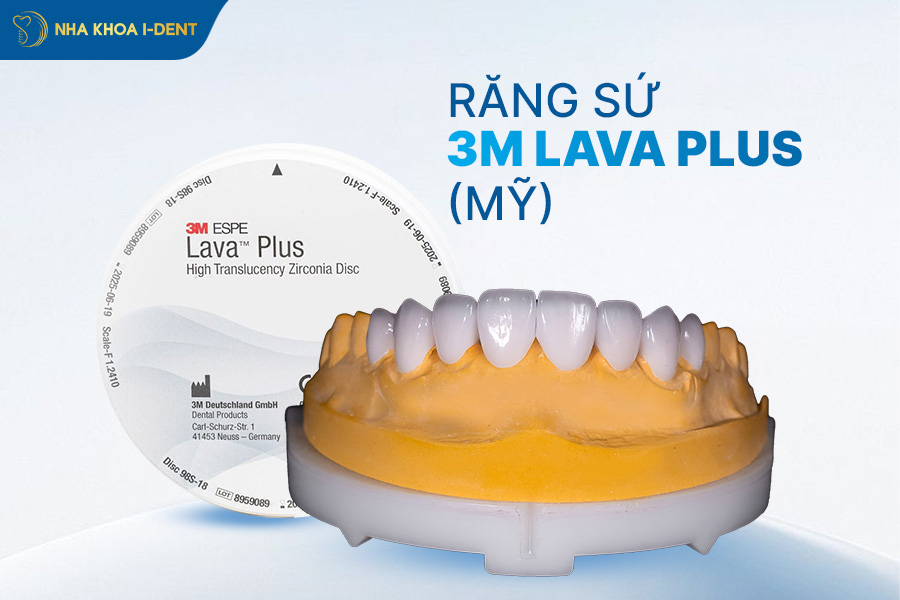 bảo hành răng sứ